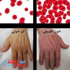 مواد غذایی خون ساز برای بدن کدامند؟