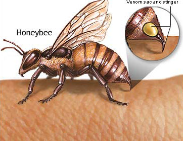 🐝زهر زنبور ابرمیکروب مقاوم را از بین می برد