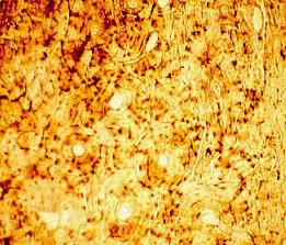  این سلولها ستاره‌ای شکل‌اند و دو هسته بیضی و پر از کروماتین دارند. هر استئوسیت در پیرامون خود لاکونا دارد. برای جلوگیری از مرگ سلولی ، استئوسیتها توسط زواید بسیار ظریف سیتوپلاسمی به یکدیگر مرتبط هستند. استئوسیتهایی که در نواحی عمیق یا پیر بافت استخوانی قرار دارند دارای شبکه آندوپلاسمی ناصاف و دستگاه گلژی کمتری هستند. تا زمانی که صدمه‌ای به استخوان وارد نشود، استئوسیتها تقسیم نمی‌شوند. با ایجاد ضایعه ، تقسیمات سلولها آغاز می‌شود. تعدادی از آنها به صورت استئوبلاست ، ماده زمینه‌ای بی‌شکل را می‌سازند و خود به استئوسیت تبدیل می‌شوند برخی دیگر به صورت سلولهای اجدادی استخوان باقی می‌مانند. 