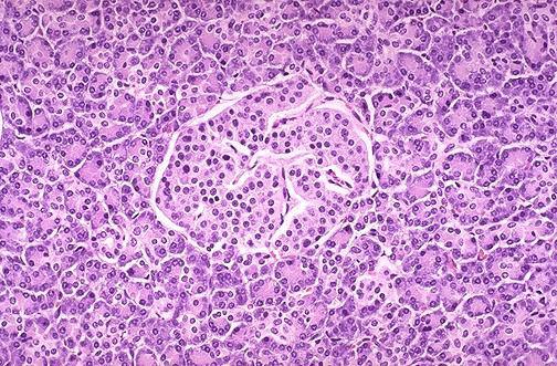  لوزالمعده یا پانکراس(Pancreas The)  یکی ازغده های گوارشی بزرگ است که در خمیدگی دوازدهه قرار دارد (ابتدای روده کوچک) وطول آن22سانتیمتر ووزنی حدود 50تا75گرم است.لوزالمعده تنها غده ای دربدن است که هم بخش درون ریز(Endocrine) وهم بخش برون ریز (Exocrine) دارد یعنی غده ای مختلط است.قسمت  برون ریز این غده بخشی گوارسی است که آنزیم ها وترکیبات قلیایی می سازد که درهضم موادغذایی نقش بسیار مهمی دارد.مادراین مورد صرفا به بخش درون ریز غده پانکراس می پردازیم که معروف به جزایر لانگرهانس می باشد.درسال 1869 یک دانشجوی پزشکی آلمانی به نام لانگرهانس اولین بار این بخش ازلوزالمعده را مورد مطالعه قرار داد  وآن را به صورت توده ای ازسلول های روشن وپراکنده وبدون مجرا مشاهده کرد که درلابلای آسینوس های (حباب ها)بخش برون ریز قرارداشتند به همین دلیل آن را مشابه جزایر پراکنده ای دانست که بعدها به اسم وی یعنی 