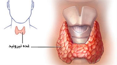 نتیجه آزمایش تیروئید را خودتان تفسیر کنید