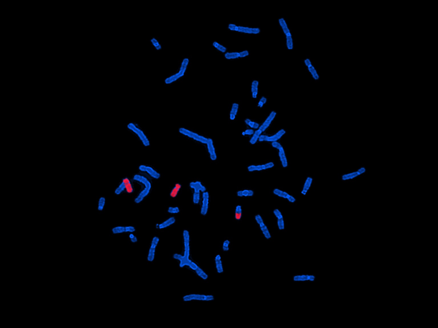 تکینک FISH یا  Fluorescent in situ hybridization 