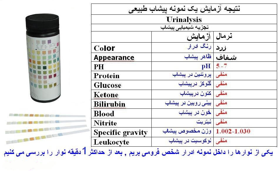 تفسیر آزمایش ادرار شما