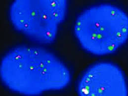 تکینک FISH یا  Fluorescent in situ hybridization 