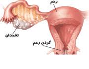 تست پاپ اسمیر و تشخیص سرطان دهانه رحم / تفسیر آزمایش پاپ اسمیر