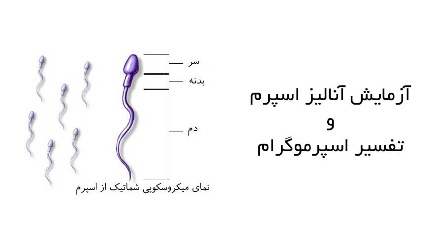 تفسیر آزمایش اسپرم