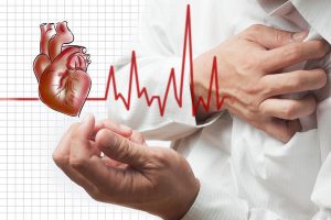 آزمایش مربوط به حمله قلبی